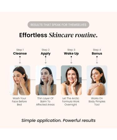 Elir Clear Skin Balm Ultimate Night Formula for Breakouts Pimples and Blemishes Helps Fade Marks and Uneven Tone Prevents New Pimples Softens Fine Lines and Enlarged Pores - Buy Online on GoSupps.com