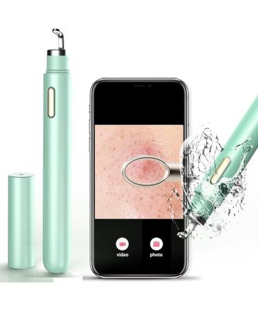 Visible Blackhead Remover with Camera Advanced Pimple Popper with Camera Acne Comedone Whitehead Extractor Kit Skin Care Pore Clean Tool - Buy Online on GoSupps.com
