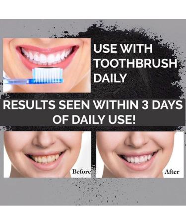 Natural Activated Charcoal Teeth Whitening Powder - 2.01 oz | Worldwide Shipping - Buy Online on GoSupps.com