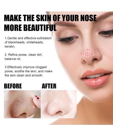 Effective Blackhead Remover Mask & Nose Strips for Clear Skin | International Shipping - Buy Online on GoSupps.com