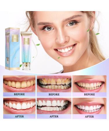 Dazzle White 2Pcs Niacinamide Whitening Toothpaste Fresh Breath Remove Tooth Stains - Buy Online on GoSupps.com