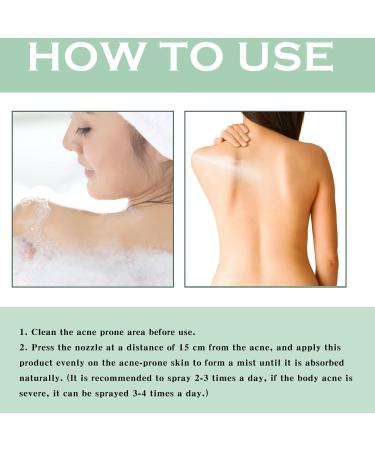 Acne Treatment Spary Back Acne Treatment Serum Body Moisturiser For Acne Body Moisturiser For Dry Skin Acne Moisturiser Reduce Back Acne & Body Acne Smoothing Moisturiser For Acne Prone Skin-120ml - Buy Online on GoSupps.com