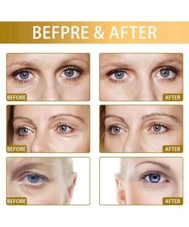 Snail Peptide Energetic Eye Roll-On Hydrating Snail Peptide Eye Cream Firming Eye Cream Hydrating Snail Eye Cream Under Eye Roller cream Eye Cream for Dark Circles and Puffy Eyes Eye Cream Anti-aging - Buy Online on GoSupps.com