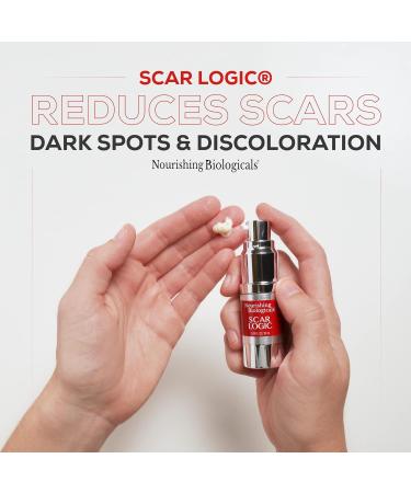 Scar Logic Advanced Treatment Cream for Face & Body | Scar Remover for Acne, Surgical, Stretch Mark & Burn Scars | Nourishing Biologicals (20ml) - Buy Online on GoSupps.com