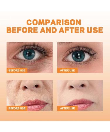 Highprime Collagen Film & Mist Set - Korean Technology for Anti-Aging Effects | 5 Pack Soluble Film & 1 Bottle Mist by Dermance Korea - Buy Online on GoSupps.com