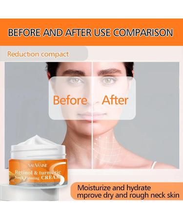 Turmeric Neck Firming Cream Neck Firming Cream Retinol Neck Cream for Sagging and Tightening Turmeric Neck Tightening Cream for Anti Aging Fade Fine Lines & Wrinkle Neck Double Chin Reducer-Face&Neck - Buy Online on GoSupps.com