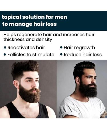 Serum Pousse Cheveux Anti Chute de Cheveux Homme Hair Growth Pousse Cheveux Tr s Rapide Favorise la Pousse des Cheveux Plus pais Hydrate Racines et R pare Cheveux Secs Fourchus et Cassants - Buy Online on GoSupps.com