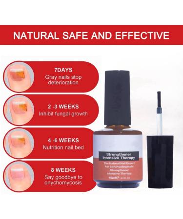 Nail Strengthening Treatment for Damaged Nails Nail Polish Strengthener Nail Hardner Oil Clear Nail Polish Strengthening Nail Growth and Strengthener Extreme Strength Nail Serum Nail Repair Serum - Buy Online on GoSupps.com