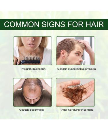 Rosemary Hair Growth Oil | Hair Loss Treatment | Stimulates Growth, Strengthens & Nourishes Scalp | For Men & Women | 2.02 Oz - Buy Online on GoSupps.com