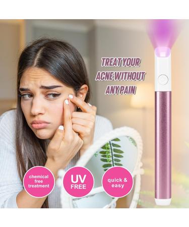 ASAB Light Therapy Acne Spot Treatment Pen Acne Scar Treatment Wrinkles Removal Spot Stick Blue and Red Light Therapy for Teenager Face Skincare Adult Beauty Device Fit for All Skin Types(Pink) - Buy Online on GoSupps.com