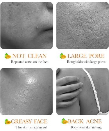 Papaya Goats Milk Soap Bar for Hyperpigmentation & Dark Spots - Vitamin C Face Wash for Clean Skin - Oil Control & Hydration - Buy Online on GoSupps.com