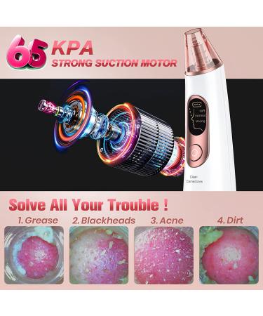 Blackhead Remover Pore Vacuum - LED Screen, USB Rechargeable Cleanser with 3 Suction Power Levels - For Acne, Whitehead Removal - 4 Probes - Women & Men - Buy Online on GoSupps.com