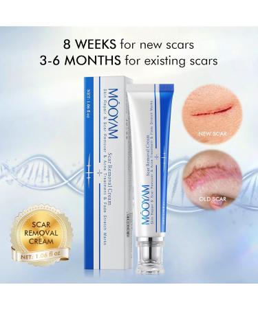 Advanced Scar Removal Cream for Face & Body - Effective Treatment for Keloids C-Section Surgery Burns & Acne - 30g/1.06 fl oz - Buy Online on GoSupps.com