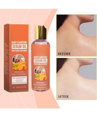 Whitening Oil Super Whitening Oil Body Skin Lightening Carrot Oil Korean Essential Oil Whitening And Freckle Removing Essence Facial Oil Dark Spot Corrector Serum For Face & Body (1) - Buy Online on GoSupps.com