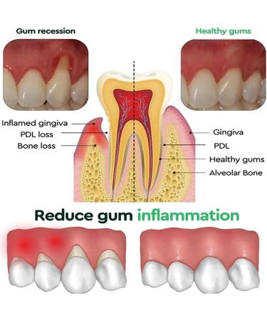 Dentizen Gum Regrowth Drops | Natural Gum Restore Liquid Mouthwash (2pcs) | International Shipping Available - Buy Online on GoSupps.com