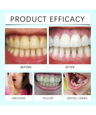 Bande Blanchiment Dentaire Bandes De Blanchiment Des Dents Blanchiments Dentaire Whitening Strips Eliminer Fumer Caf Soda Vin Tache Douces Pour Les Dents (3) - Buy Online on GoSupps.com
