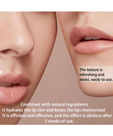  homomdy Turmeric Lip Balm for Dried and Cracked Lips Turmeric Lip Lightening for Dark Lips Lip Wrinkle Reduction Dull Dark Lip (6pcs) - Buy Online on GoSupps.com