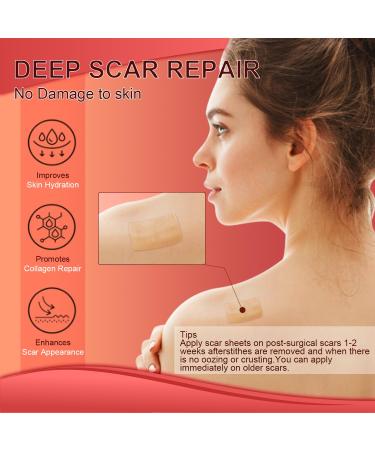 Medical Grade Silicone Scar Sheets - 1.6 x 60 Roll Reusable Scar Tape for Surgery C-Section Burn & Acne Removal - Buy Online on GoSupps.com