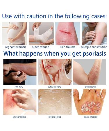 Beeergift Salbe Cream for Psoriasis | Professional Bee Venom Skin Repair | Soothing Care & Itch Relief - 2 Pieces - Buy Online on GoSupps.com