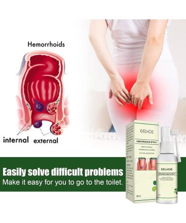 MatureGirl Hemorrhoids Spray 30ml - Soothes Swelling & Itchy Skin, Body Care & Antipruritic Relief - Buy Online on GoSupps.com