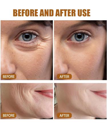 Granactive Retinoid 2% Emulsion Retinol Serum Retinol Serum for Face Retinol Anti-Aging Face Serum Face Moisturiser Retinol Face Serum Hydraulic Acid Serum for Face Anti Wrinkle Serum Fade Fine Lines - Buy Online on GoSupps.com