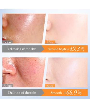 Whitening Niacinamide Serum - Face Serum for Women - Hyaluronic Acid Serum for Face - Skin Care for Dark Spot Correcting Glow Serum - Face Serum for Anti-Ageing and Wrinkles (30ml) - Buy Online on GoSupps.com