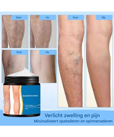 Leg Cream Against Swelling 50g Calf Repairing Lotion Care Product For Home Work Office Teachers Pregnant Walkers - Buy Online on GoSupps.com