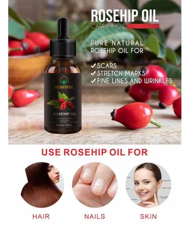 Besstoil Rosehip Seed Oil 100% Pure Natural Cold Pressed Unrefined Non-GMO Carrier Oil - Anti-Aging Moisturizer for Face, Skin, Hair & Nails - 3.52 oz - Buy Online on GoSupps.com