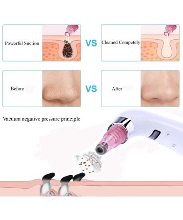 Blackhead Remover Electric Rechargeable Facial Pore Cleanser Exfoliating Cleansing Skin Acne Extractor for Facial Skin Cleansing - Buy Online on GoSupps.com