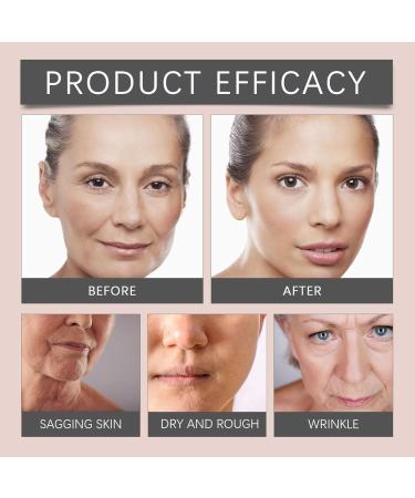 Paracresse Face Oil Organic Paracresse Face Serum Paracresse Serum Face Oil with Paracresse Extract Anti-Wrinkle Serum Reduces Wrinkles and Fine Lines (1) - Buy Online on GoSupps.com