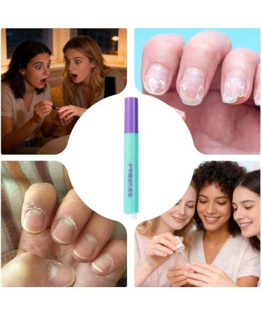 Stylo Poussoir Huile Pour Cuticules 2 En 1 Avec Pointe En C ramique De Pr cision 6 G Stylo Huile Pour Ongles Portable Fortifiant Hydratant Pour Ongles Doux Pour Manucure De Qualit Salon - Buy Online on GoSupps.com