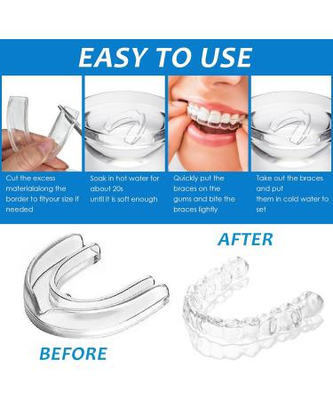 Bruxism Pack of 4 Dental Gutters Mouth Guards Teeth Gutters Mouth Guard for Grinding Teeth 2 Sizes Tooth Gutters Improve - Buy Online on GoSupps.com