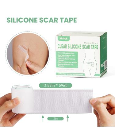 Mebak Clear Silicone Scar Gel Tape Roll (1.6 x 60) - Acne & C-Section Scar Removal Treatment - Reusable Transparent Strips for Keloid Surgery - Scars Treatment Sheets - Buy Online on GoSupps.com