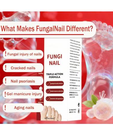  JINGLING JINGLING Nail Repair Liquid - 15ml Deep Nourishing Non-Greasy | Solution for Dry Nails and Dry Feet | Men Adults Teenagers Seniors Athletes Home Travel Gym Camping - Buy Online on GoSupps.com