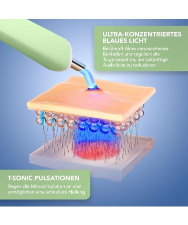 Foreo Espada 2 Plus LED Skin Care Device - Targeted Treatment for Impurities Scars & Stains - FDA Approved - Medical Silicone - Pistachio - Buy Online on GoSupps.com