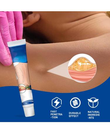 Lipoma Removal Cream Cr me D' limination Des Lipomes Pommade Apaisante pour Les Lipomes Pommade de Suppression s re Utiliser pour Les Gros Morceaux Cr me D' limination des Lipomes V g taux 20G - Buy Online on GoSupps.com