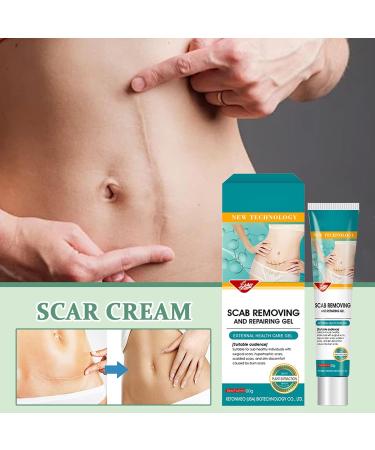 Scar Cream - 20g Soothing - Advanced Repair Cream for Scars For Comfort Recovery Burn Protection Domestic Body Injury - Buy Online on GoSupps.com