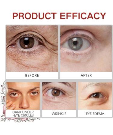 Rose Eye Cream Under Eye Cream for Dark Circles Eye Bags Remover Hydrating Eye Cream Rose Eye Cream Anti Aging Dark Circles Under Eye Treatment For Puffy Eyes Fine Lines Firming & Brightening - Buy Online on GoSupps.com
