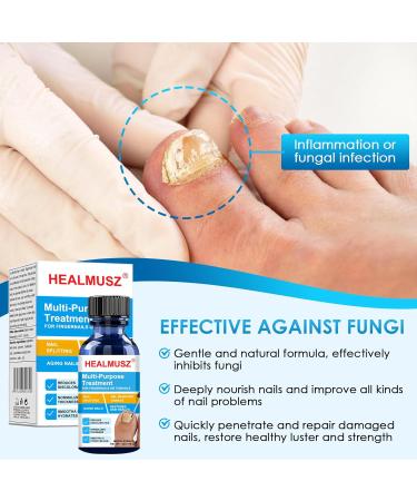 Yagaspantery 30 ml toenails caring nail repair protection and strengthening of brittle nails moisturizes dry nail skin for beautiful and wellgroomed nails nail growth and repair serum white - Buy Online on GoSupps.com