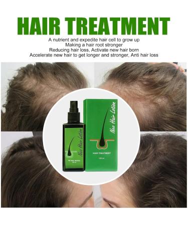  Huien Huien Hair Growth Serum for Men and Women 120 ml Hair Regrowth Lotion and Hair Growth Care DHT Blocker - Buy Online on GoSupps.com