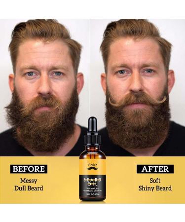 Youpo Beard Growth Oil for Men | 30ml Moisturizing Natural Beard Softener & Mustache Strengthener - Buy Online on GoSupps.com