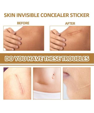 TatttooCover Up Sticker Skin Scar Pimple Sticker Skin Concealing Patches 60 Soft Breathable Latex TatttooCover Up Stickers for Scars and Taattoos Waterproof Skin Tone Inv - Buy Online on GoSupps.com