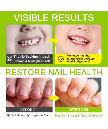 Vernis Anti-Morsure d'Ongles | Stylo Pr vention Habitudes Ronger Ongles Doigts 7ml | Solution Naturelle Anti Onychophagie Soin Nomade Adultes Arr ter de Ronger - Buy Online on GoSupps.com