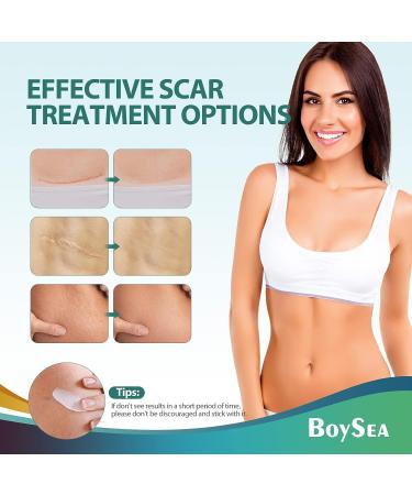 Boysea Advanced Scar Cream - 1.7 oz | Silicone Gel for Old & New Scars | Keloid, C-Section, Surgery, Burn, Acne Treatment - Buy Online on GoSupps.com