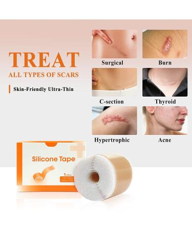 Carbou Medical Silicone Scar Tape Roll - 1.6â€‌ x 60â€‌ Scar Treatment & Wound Dressing - Buy Online on GoSupps.com