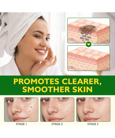 Miqicos Bee Venom Comprehensive Cream New Bee Venom Restoration Cream Effective in Reducing Skin Imperfections Anti-Aging Hydrating Natural Serum Suitable for All Skin Types (2) - Buy Online on GoSupps.com