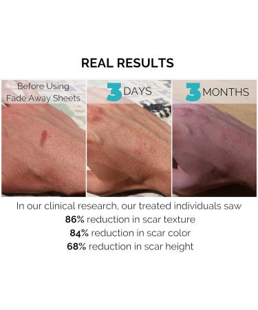 Fade Away Scars - Original Silicone Scar Sheeting Roll | Custom Size Medical Grade Scar Sheets & Strips for Effective Scar Treatment - Buy Online on GoSupps.com