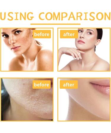 Kojic Acid Soap Turmeric Soap Bar Lemon Turmeric Kojic Acid Soap Bar for Acne Fine Lines Kojic Acid Soap Original for Deep Cleansing Turmeric Brightening Soap Smooth Skin Dark Spot Corrector Remover - Buy Online on GoSupps.com