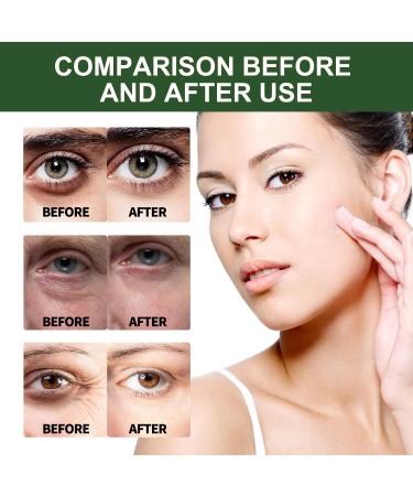 Ceramide Moisturiser Face Serum for Women - Retinol Serum for Face - Anti Aging Serum for Face - Smooth Tender Fine Line Restore Elasticity - Reduce Wrinkle Dullness Anti Oxidation Moisture Hydrate - Buy Online on GoSupps.com