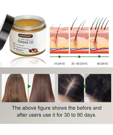 Dr. Sebi Batana Oil - 100% Pure Hair Growth Oil | Unrefined Hair Loss Prevention & Thickness Enhancer for Men & Women | 4.23 OZ - Buy Online on GoSupps.com